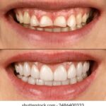 2025194期3d开奖结果最新公布,快来看看中奖号码! nwhsj433pt